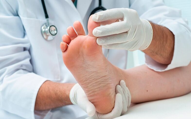 how and how to treat foot fungus