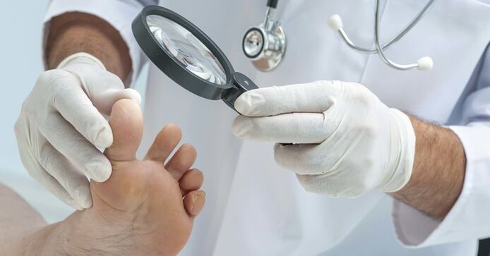 Diagnostic examination of the toenails