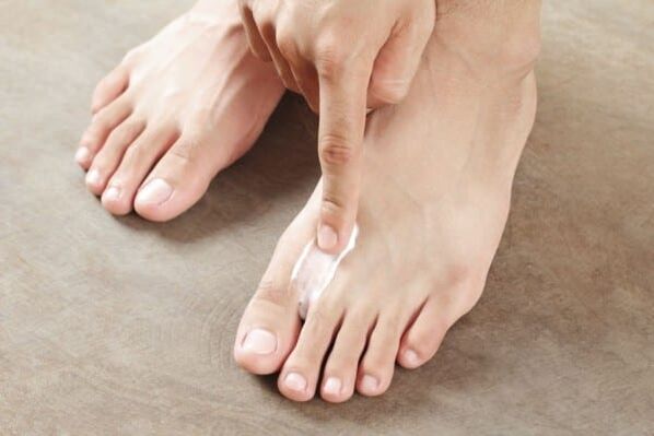 application of fungal ointment on the skin of the feet