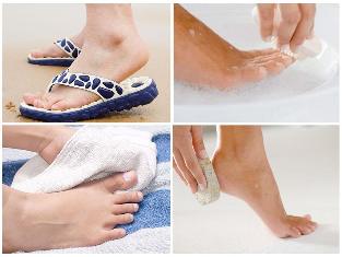 the fungus on the skin, the Prevention of foot